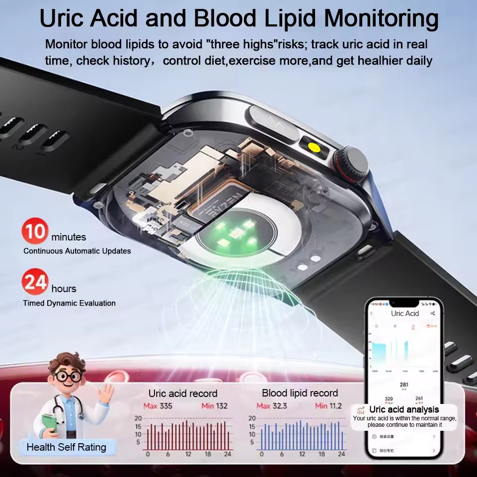 2026 New Health Smart Watch La - Italian Jewelry Watches recension och pris